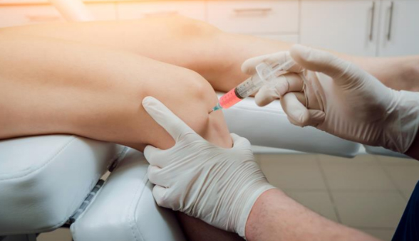 Platelet-Rich Plasma (PRP) Therapy for Knee Arthritis