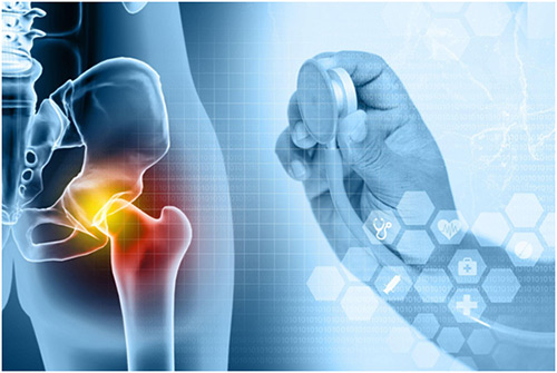 Revolutionizing Hip Replacement Surgery: Cutting-Edge Innovations and Breakthroughs