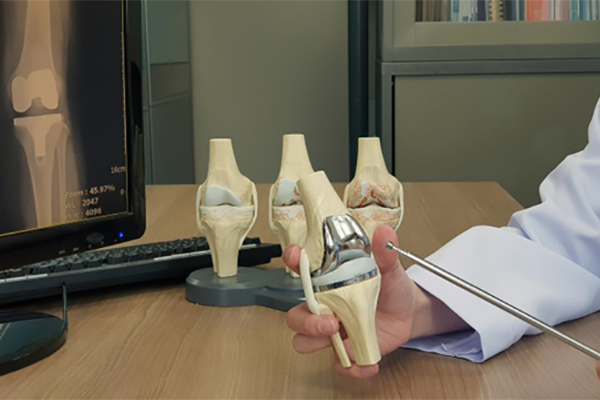 Why Surgical Experience Matters: The Benefits of Choosing a High-Volume Mako Robotic Surgeon